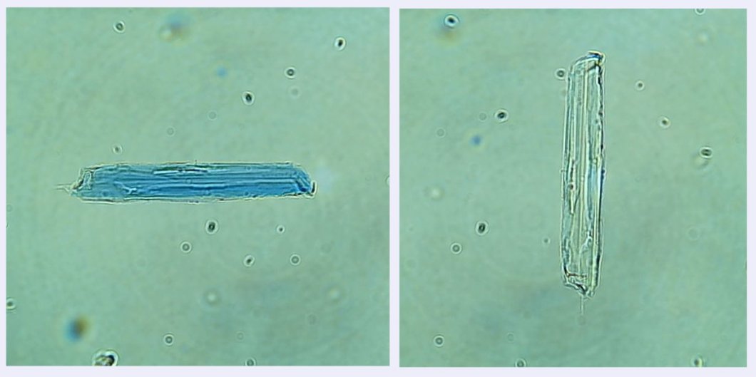 Fig 6. composicio dumortierita