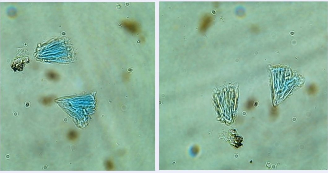 Fig 7. composicio cianotriquita 1